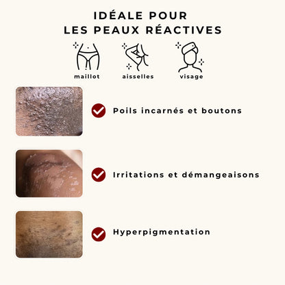 Melanin Glow - Sérum anti poils incarnés