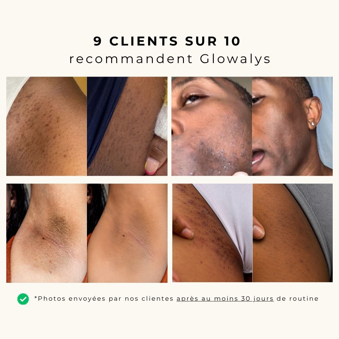 Melanin Glow - Sérum anti poils incarnés